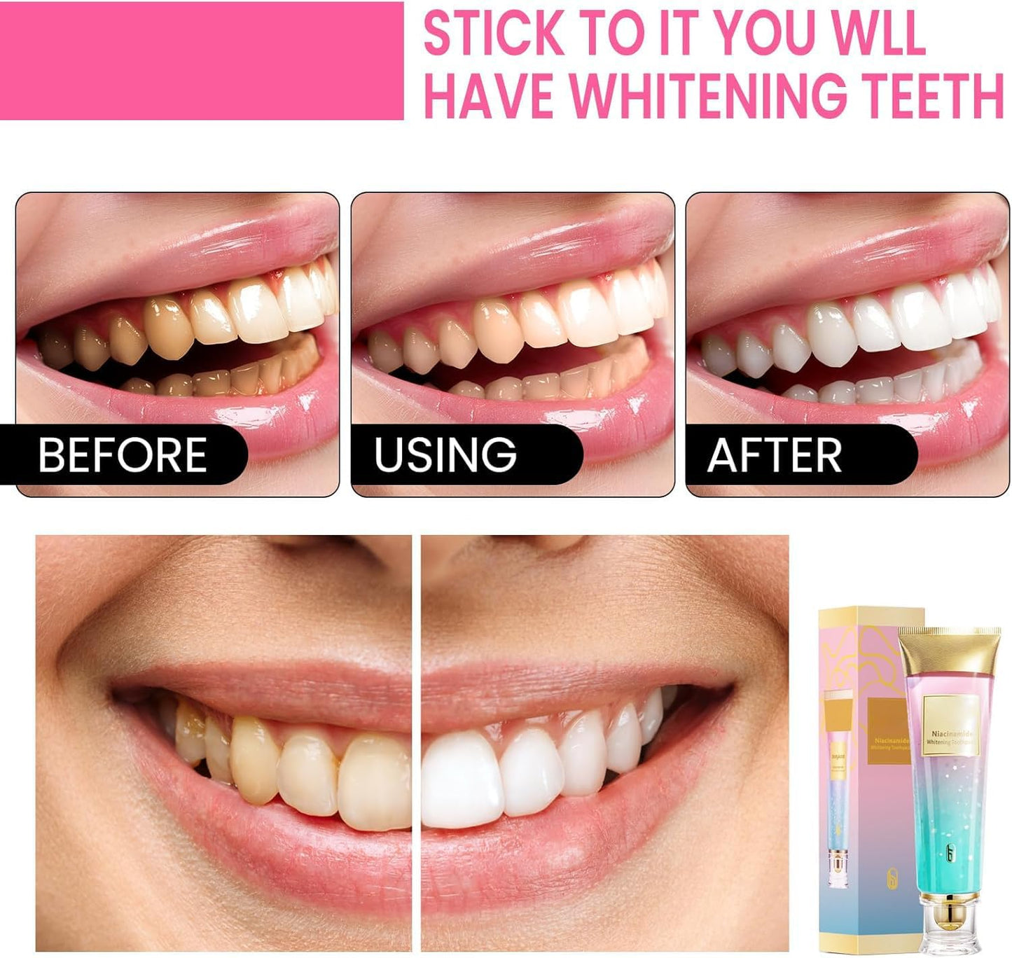 1PC Niacinamide Whitening Toothpaste, Whitening Toothpaste,Fresh Breath Remove Tooth Stains