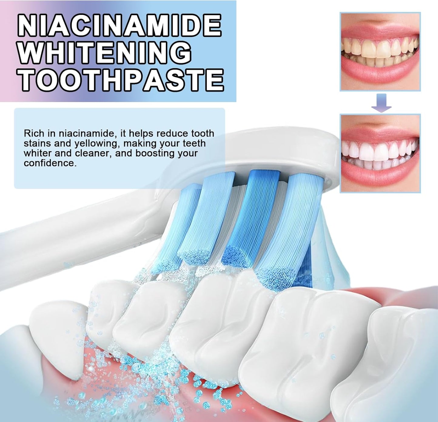Niacinamide Whitening Toothpaste - Complete Care, Fresh Breath, Stain Removal