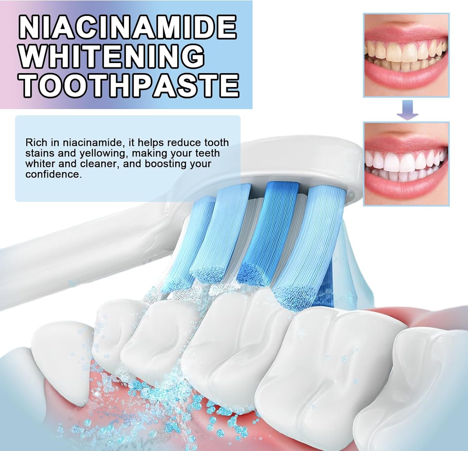 Niacinamide Whitening Toothpaste - Complete Care, Fresh Breath, Stain Removal